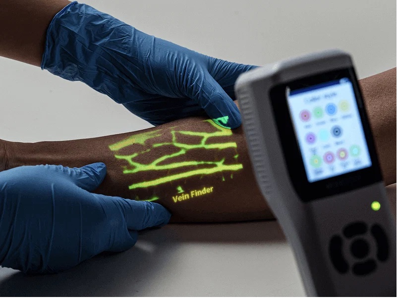 Vein Finder